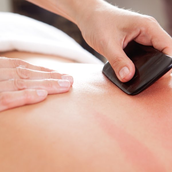 Gua Sha treatment at DiYi TCM